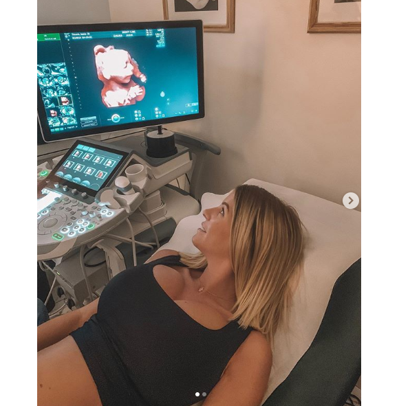 Jessica Thivenin, enceinte de son premier enfant, s'affiche face aux images de son bébé chez son gynécologue, le 12 juin 2019.