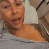 Amber Rose partage son opération de chirurgie esthétique à ses followers le 28 novembre 2019.