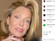 Caroline Receveur : Ridée et méconnaissable, son étrange "cadeau" de Noël