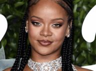 Rihanna sans maquillage : elle assume un immense bouton sur son visage