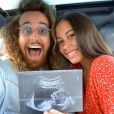Pekin Express : Alizée et Maxime attendent leur premier enfant (mai 2020).