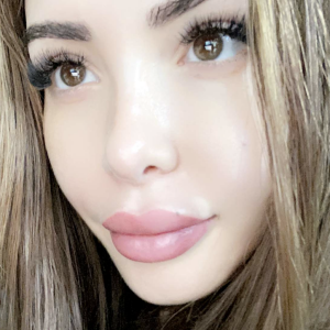 Nabilla dévoile le résultat de ses lèvres depuis son "lip blushing" - Snapchat, 22 janvier 2021