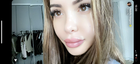 Nabilla dévoile le résultat de ses lèvres depuis son "lip blushing" - Snapchat, 22 janvier 2021