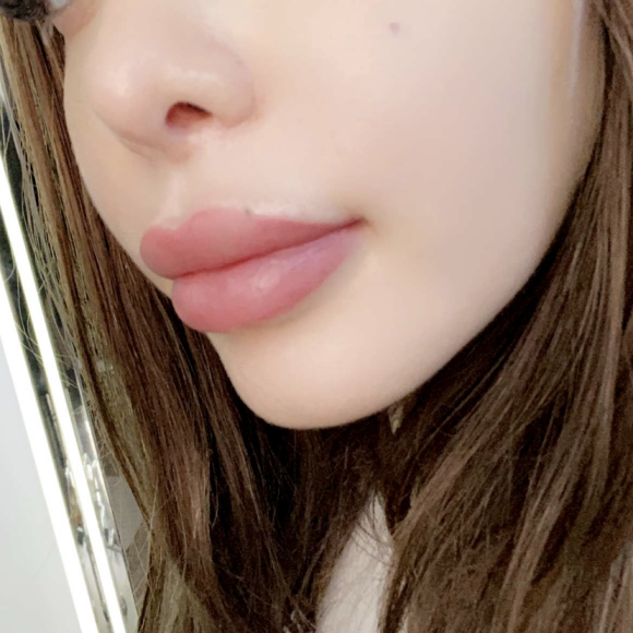 Nabilla dévoile le résultat de ses lèvres depuis son "lip blushing" - Snapchat, 22 janvier 2021