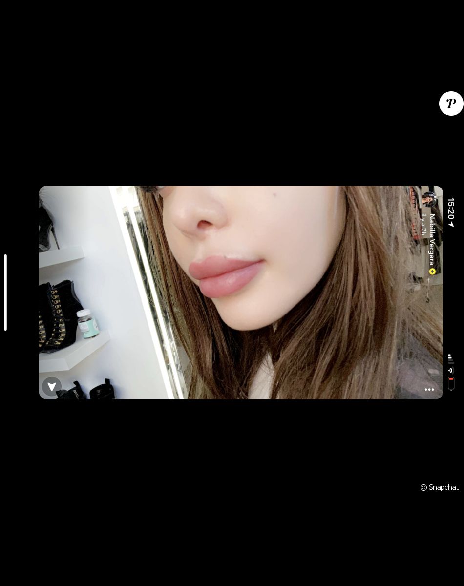 Nabilla dévoile le résultat de ses lèvres depuis son "lip blushing" - Snapchat, 22 janvier 2021
