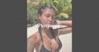 Inès (Koh-Lanta), nouvelle chirurgie en vue après sa poitrine : "On dirait une alcoolique"