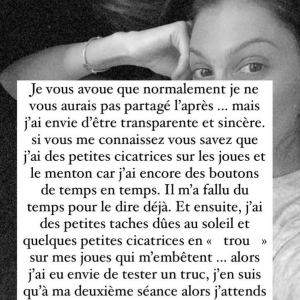 Iris Mittenaere dévoile son visage marqué de plaques rouges après une intervention au laser - Instagram