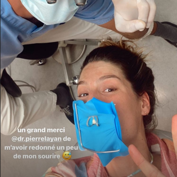 Laury Thilleman s'est cassée une dent et a dû subir une intervention chez le dentiste - Instagram