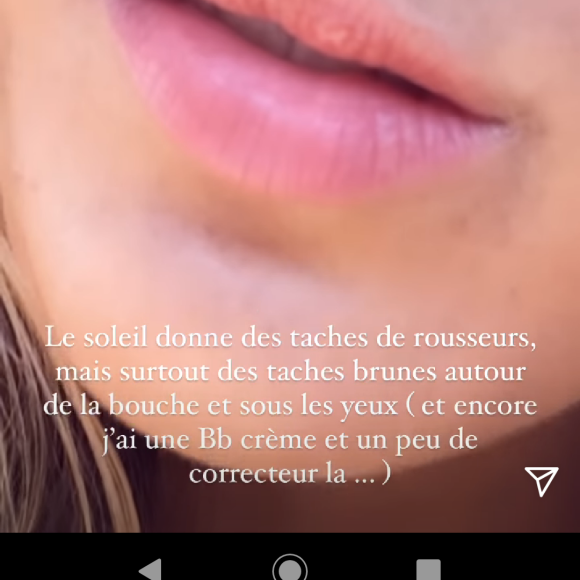 Iris Mittenaere se confie sur un complexe physique en story Instagram, le 9 juin 2021