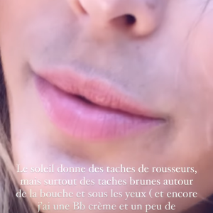 Iris Mittenaere se confie sur un complexe physique en story Instagram, le 9 juin 2021