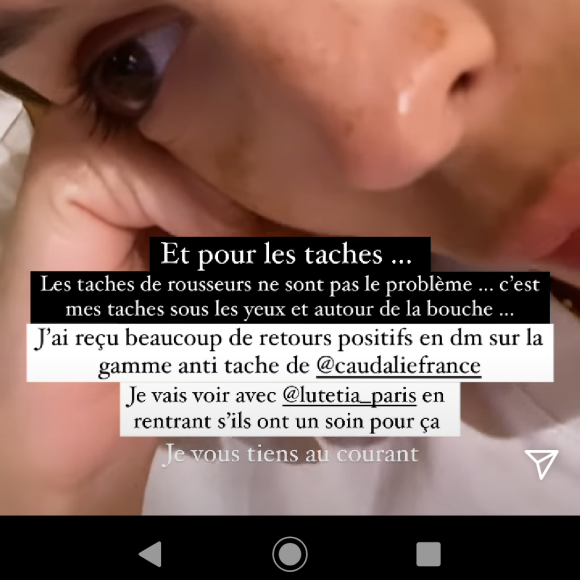 Iris Mittenaere se confie sur un complexe physique en story Instagram, le 9 juin 2021