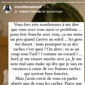 Iris Mittenaere se confie sur un complexe physique en story Instagram, le 9 juin 2021