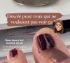 Alexandra, aventurière phare de "Koh-Lanta", partage une vidéo de son ongle qui se décolle, sur Instagram.