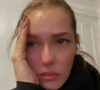 Maeva Coucke en larmes : elle confie avoir subi une opération très douloureuse sur Instagram