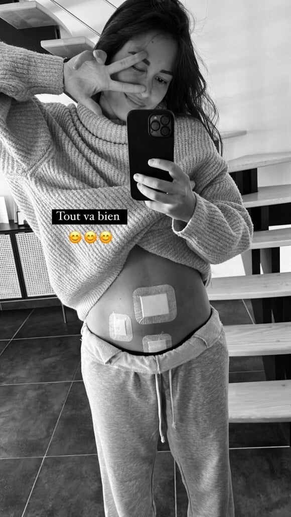Alizée, ancienne candudate de Pékin Express, a partagé une photo d'elle le ventre couvert de pansements. Elle a été opérée de l'appendicite. Le 22 janvier 2022.