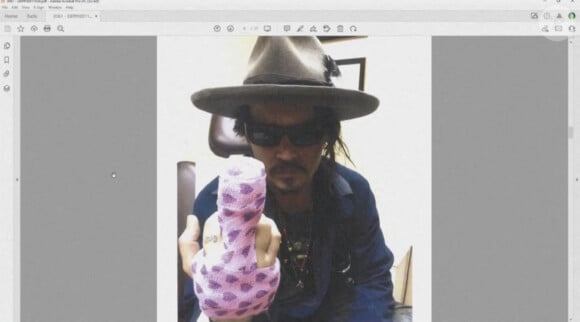 Johnny Depp montre son doigt bandé sur une photo prise au cabinet de son médecin. Los Angeles, le 20 avril 2022. Johnny Depp demande 50 millions de dollars de réparation suite à une interview d'Amber Heard dans le Washington Post, qui lui aurait été très préjudiciable professionnellement. Los Angeles, le 20 avril 2022. 