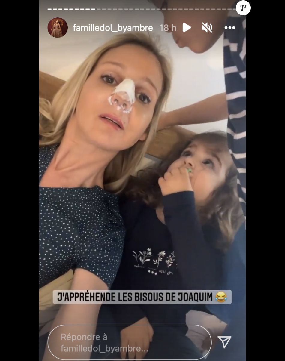 Ambre Dol (Familles nombreuses, la vie en XXL) opérée du nez - Instagram
