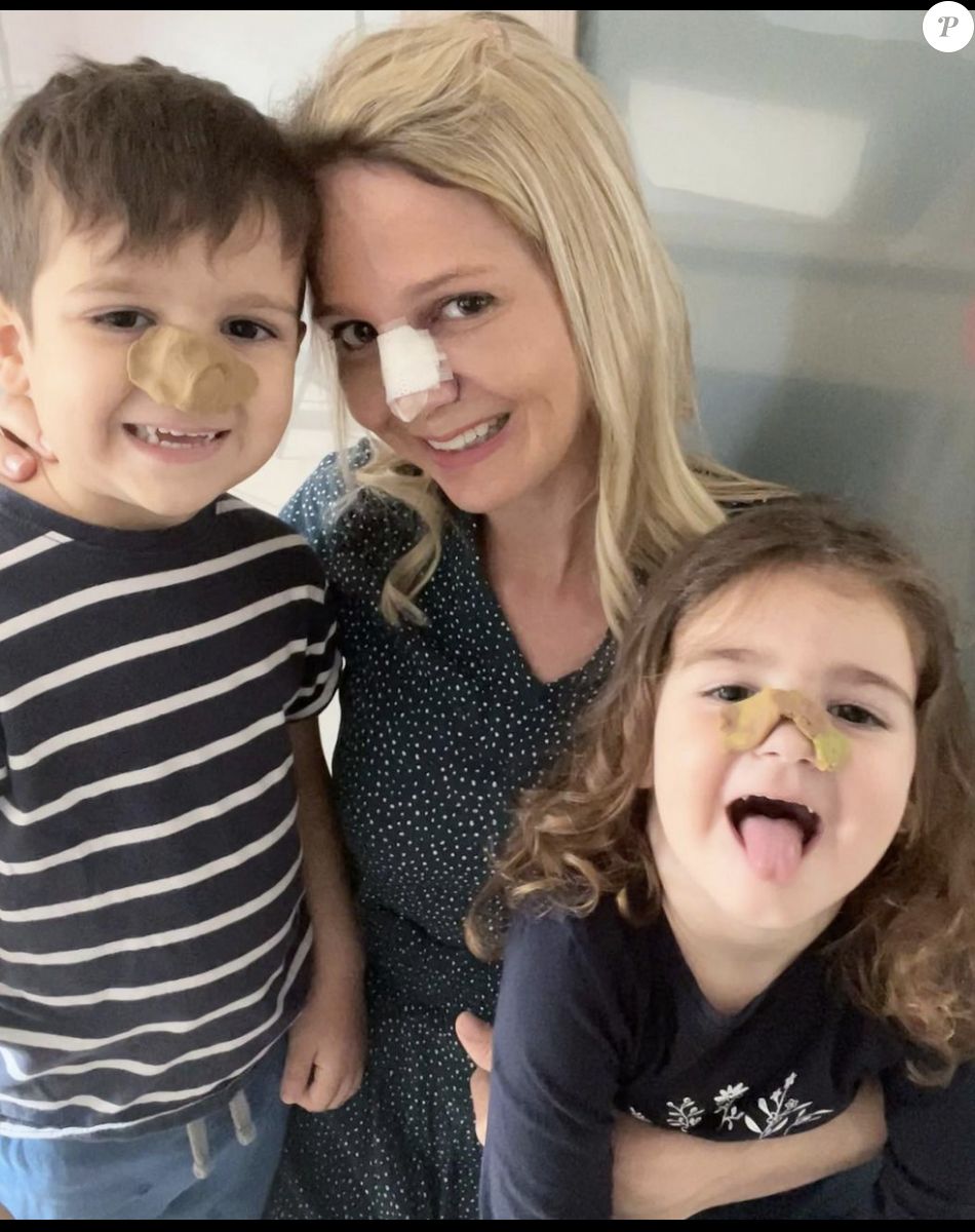 Ambre Dol (Familles nombreuses, la vie en XXL) opérée du nez - Instagram