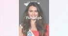 "J'aurais pu perdre la vue" : révélation de Diane Leyre (Miss France) sur l'origine de sa cicatrice