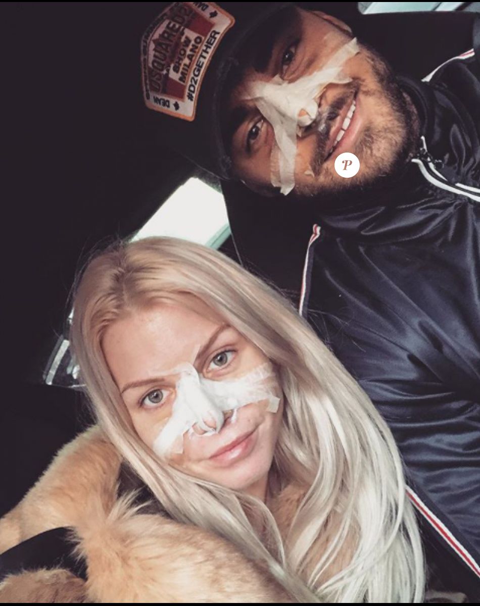 Jessica Thivenin et Thibault Garcia se sont fait refaire le nez, le 19 janvier 2018.