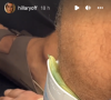 Hillary Vanderosieren partage des images du pied de Giovanni Bonamy après son accident de voiture - Instagram