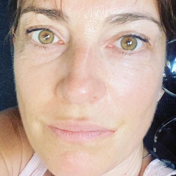 Eve Angeli dévoile les photos de son accident de la route. Le 11 août 2022.