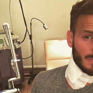 M. Pokora en pleine séance de détatouage : il fait part de sa souffrance sur son compte Instagram, le 2 avril 2016