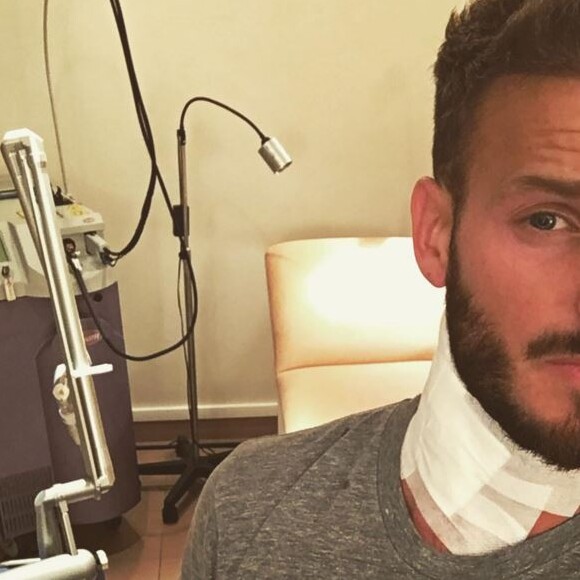 M. Pokora en pleine séance de détatouage : il fait part de sa souffrance sur son compte Instagram, le 2 avril 2016