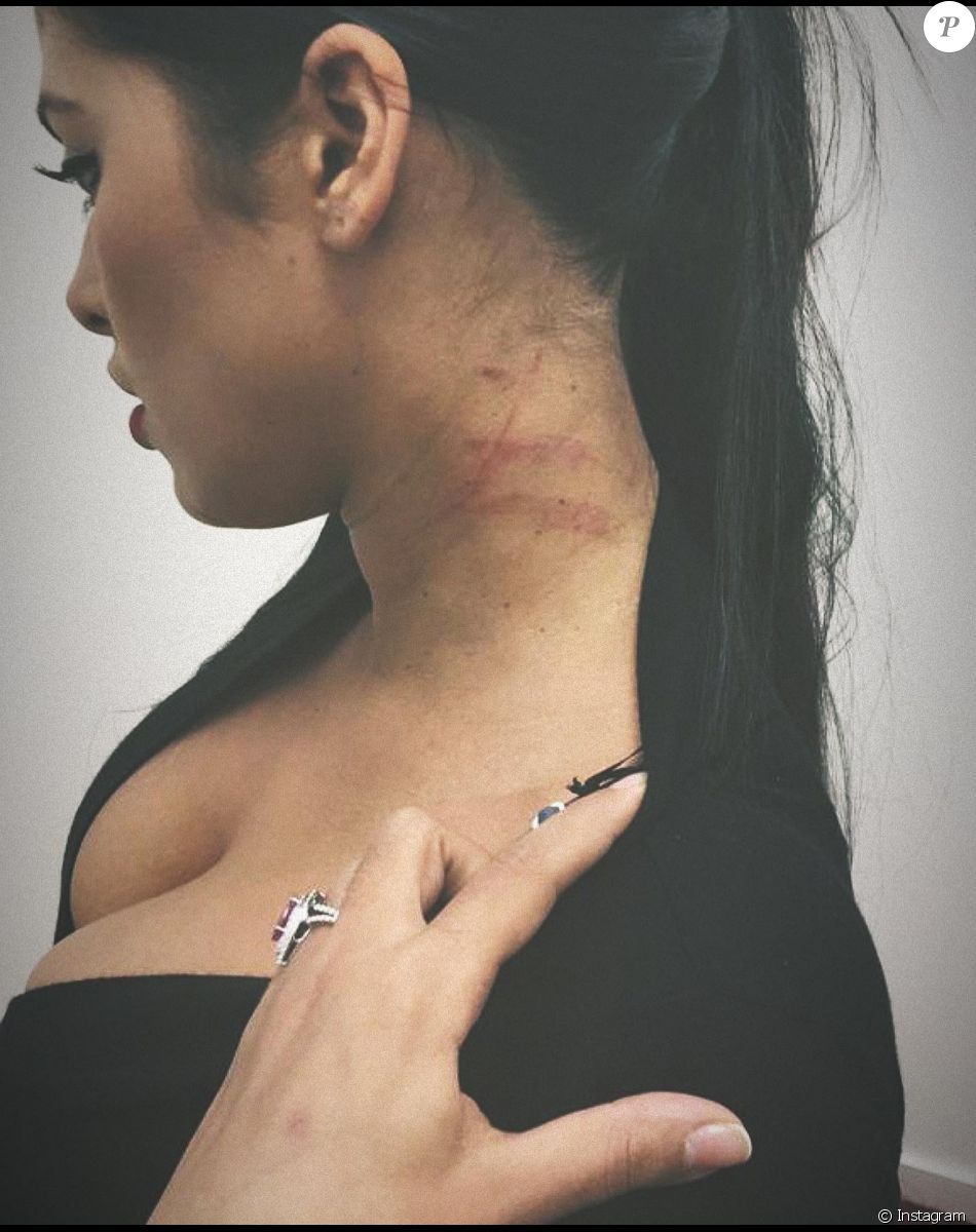 Ayem Nour dévoile une photo choc' sur Instagram