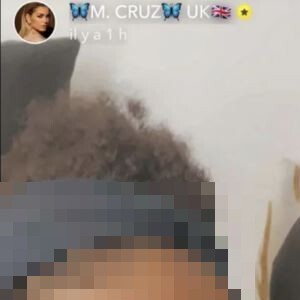 Une photo de Mélanie Da Cruz le visage abîmé fait d'ailleurs actuellement le tour de la Toile.
Mélanie Da Cruz apparaît le visage abîmé après sa bagarre avec Samantha, l'ex d'Anthony Martial.