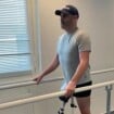 Matthieu Lartot : Après son amputation, il affiche sa prothèse pour la 1ère fois... "Bionic Mat" fait sensation