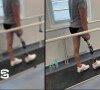 Matthieu Lartot dévoile sa prothèse et sa rééducation dans Stade 2, le 30 juillet 2023