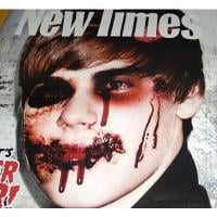 Justin Bieber : Défiguré et le visage en sang en couverture d'un magazine !