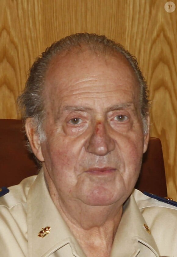 Les marques de la chute sont bien visibles... Le roi Juan Carlos Ier d'Espagne lors de sa visite le 2 août 2012 au ministère de la Défense, à Madrid. Victime d'une chute après la revue des troupes, dont résultent des contusions sur son nez et son menton, le monarque a toutefois poursuivi sa mission.