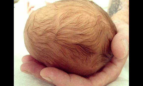 Le crâne de Finn, le bébé de Tori Spelling et Dean McDermott, né le 30 août 2012