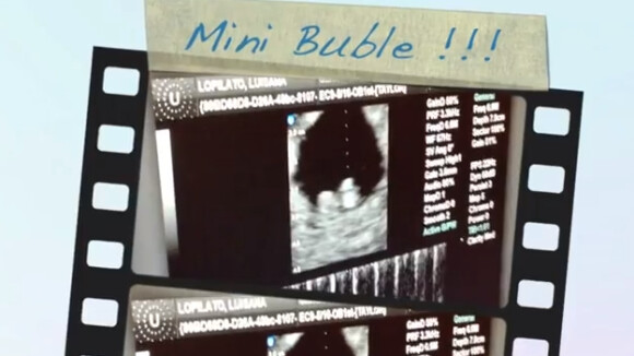 Michael Bublé et Luisana Lopilato : Un premier bébé montre le bout de son nez !