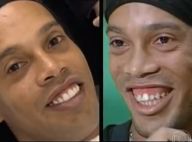 Ronaldinho opéré des dents : La star du foot montre son nouveau sourire