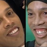 Ronaldinho opéré des dents : La star du foot montre son nouveau sourire