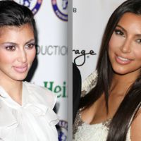 Kim Kardashian, la métamorphose : Une future mariée abonnée au bistouri...