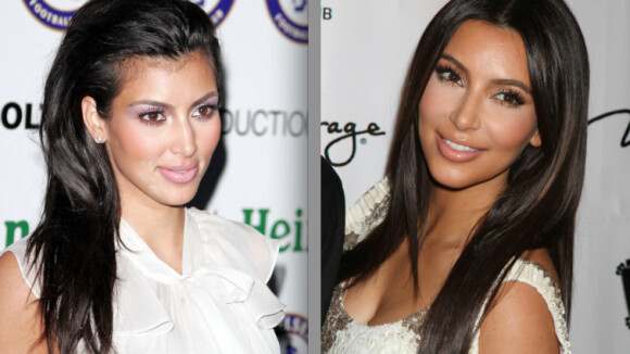 Kim Kardashian, la métamorphose : Une future mariée abonnée au bistouri...