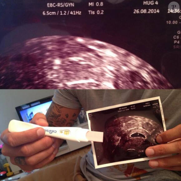 Afin de faire taire ses détracteurs, Sarah a posté sur con compte Twitter un cliché de son échographie et de son test de grossesse. Septembre 2014.