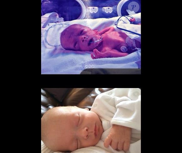 Chris Hoy a publié une photo de son fils Callum le jour de sa naissance, 11 semaines avant le terme, et une autre photo de Callum, le jour du terme prévu - photo publiée sur son compte Twitter le 27 décembre 2014