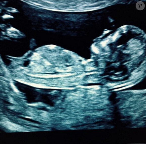 L'échographie postée par Cesc Fabregas pour annoncer l'arrivée de son deuxième bébé avec Daniella Semaan - 16 janvier 2015.
