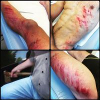 Simon Fourcade blessé : Le biathlète renversé et menacé à la hache