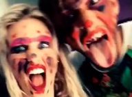 Adixia (Les Ch'tis) et Sacha (SS8) : Très amoché, le duo complice relève un défi