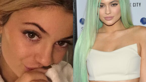 Kylie Jenner : Sortie sans maquillage et aveu sur son opération de chirurgie...