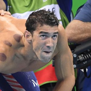 Michael Phelps présentant des marques de cupping le 7 août 2016 aux JO de Rio.