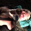 Richard Branson dévoile ses blessures sur Instagram après une violente chute à vélo, août 2016.