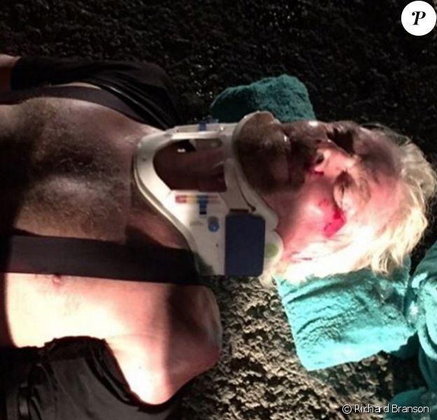 Richard Branson dévoile ses blessures sur Instagram après une violente chute à vélo, août 2016.