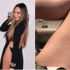 Chrissy Teigen révèle ses vergetures aux cuisses le 18 janvier 2017